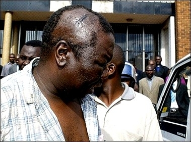 Morgan Tsvangirai beaten, March 11, 2007